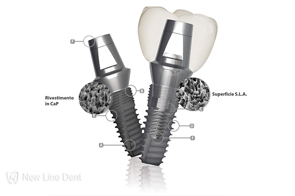 Dentium импланты отзывы